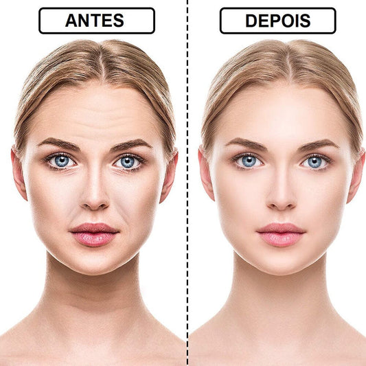 Anti-Wrinkle and Expression Line Silicone Patch